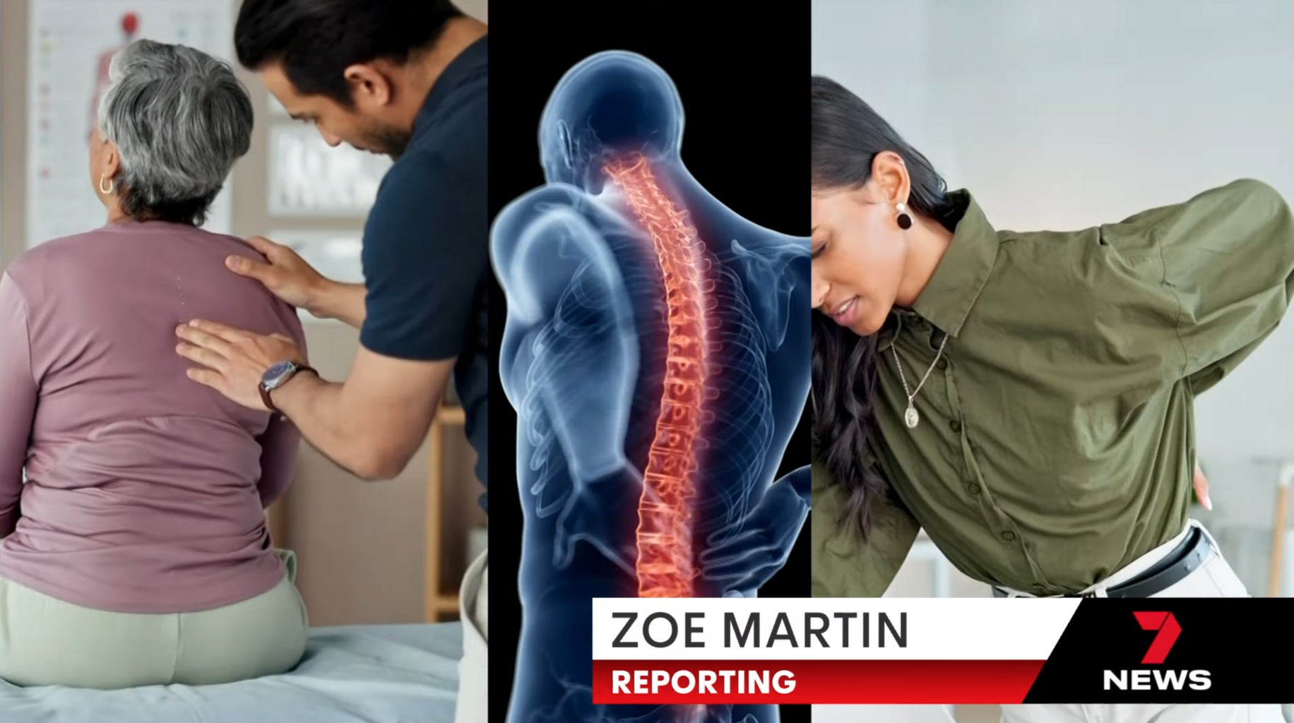 Urgent calls to find relief for millions of Aussies suffering back pain | 7NEWS