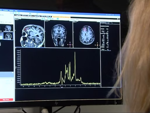 Physical changes in the brain of chronic pain patients may explain low mood